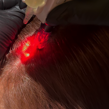 Scalp Treatment